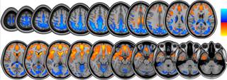 O "scanner" e diagnóstico de imagens auxilia nos estudos de mapeamento cerebral da Nasa. Crédito: Credits: University of Michigan