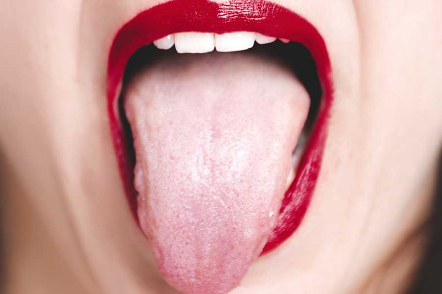 O que são essas manchas brancas na língua?